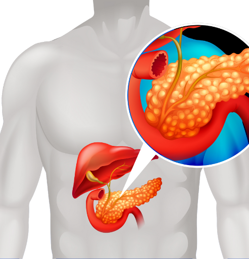 What is the pancreas