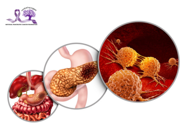 How Is Pancreatic Cancer Diagnosed