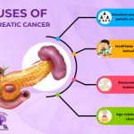 What Causes Pancreatic Cancer: Understanding Risks, Prevention, and Genetic Factors