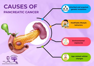 Causes of Pancreatic Cancer ()
