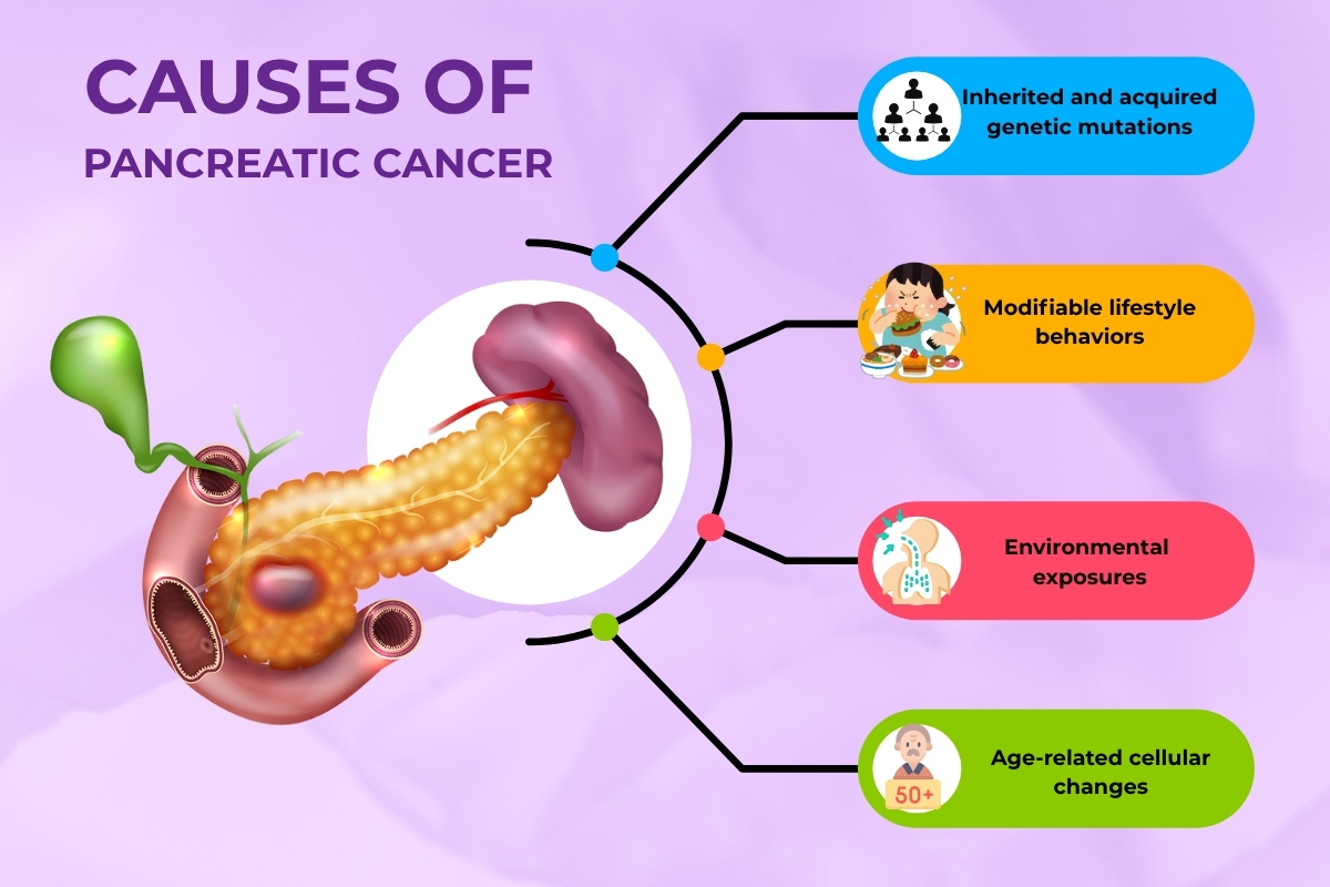 Causes of Pancreatic Cancer