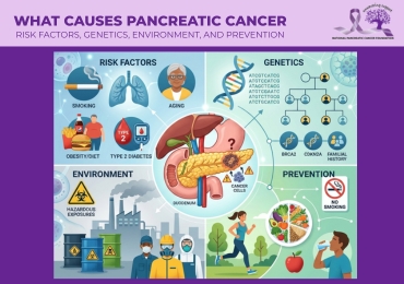 What Causes Pancreatic Cancer