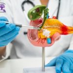 What Does the Pancreas Do? Clear Answers on Pancreas Function, Location, Symptoms, and Treatment