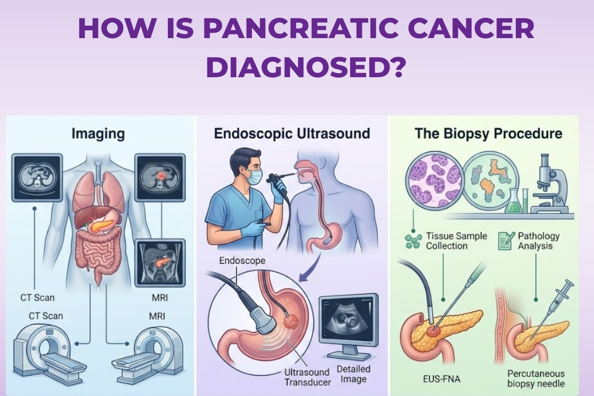 How Is Pancreatic Cancer Diagnosed